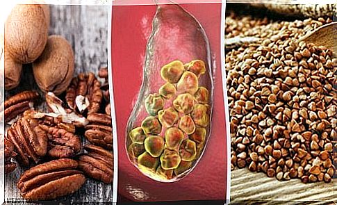 6 foods that help with gallstones