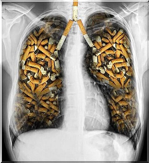 The smoker's lung is one of the misconceptions about tobacco use