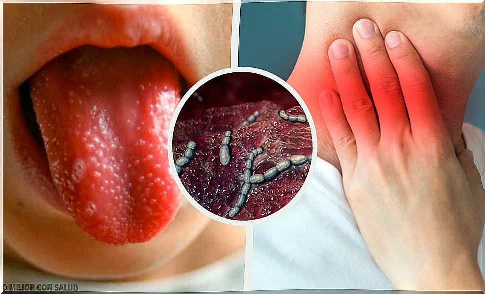 Interesting facts about scarlet fever