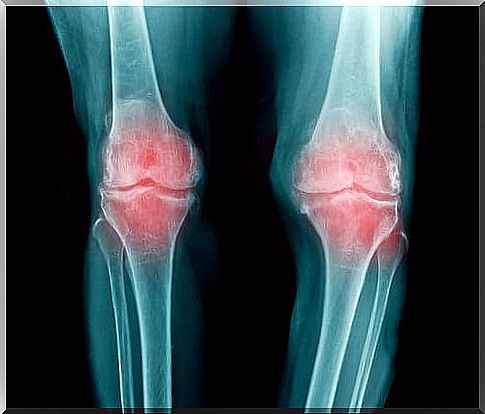 Causes of joint pain in the knee