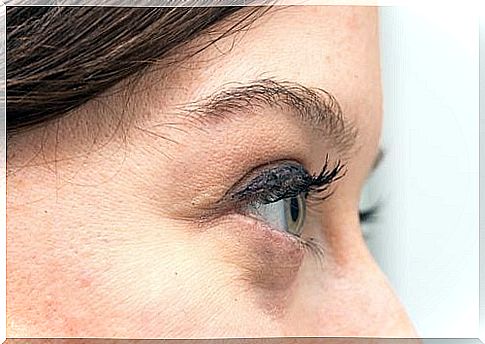 Causes and treatment options for dark circles