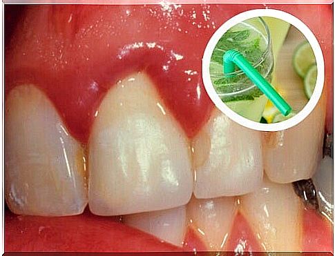 Effective, homemade mouthwash against bleeding gums