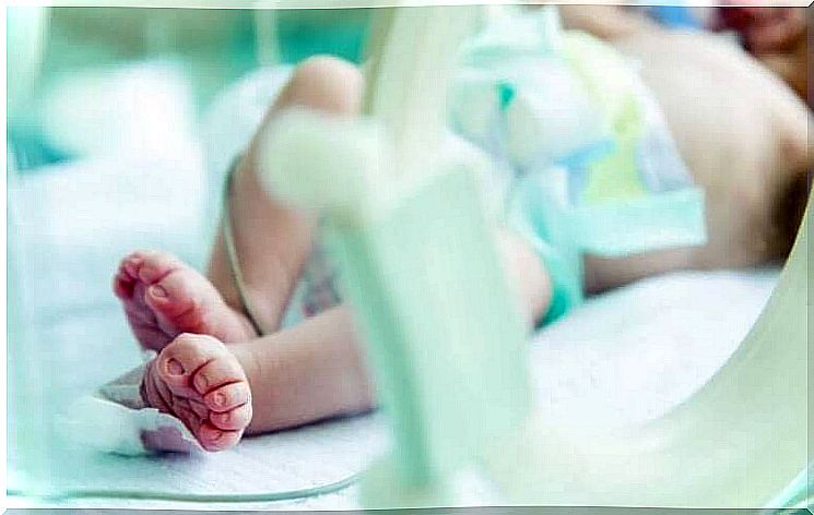 Gastroschisis: diagnosis and treatment