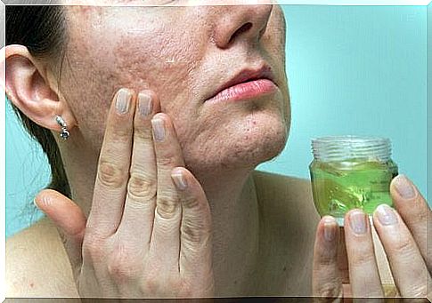 Natural solutions against scars