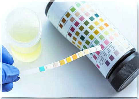 What does a urine test look at?