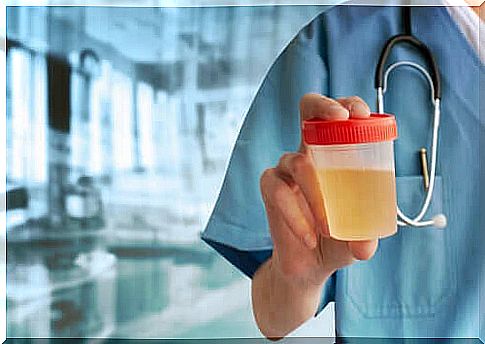 Doctor holds urine test in hand