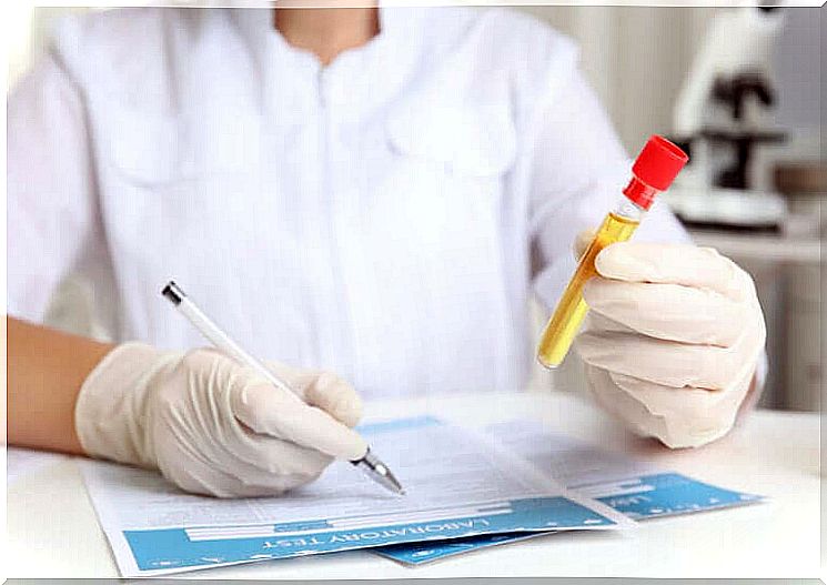 A person examines urine in the laboratory